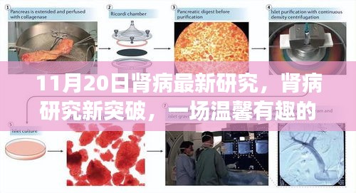 腎病研究新突破，溫馨有趣的醫(yī)學(xué)之旅（11月20日更新）