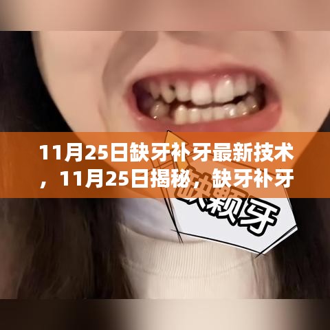 揭秘，最新缺牙補牙技術革新，引領牙齒修復新時代（11月25日）