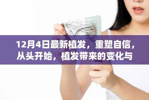 植發(fā)重塑自信，從頭開始的自我重塑之旅